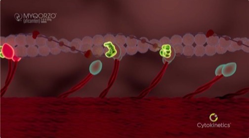 Thumbnail for video: Understanding the Mechanism of Action of MYQORZO™ (aficamten) in Obstructive Hypertrophic Cardiomyopathy